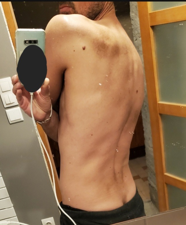 Yunus-emre - Sabadell - Barcelona | Sexo